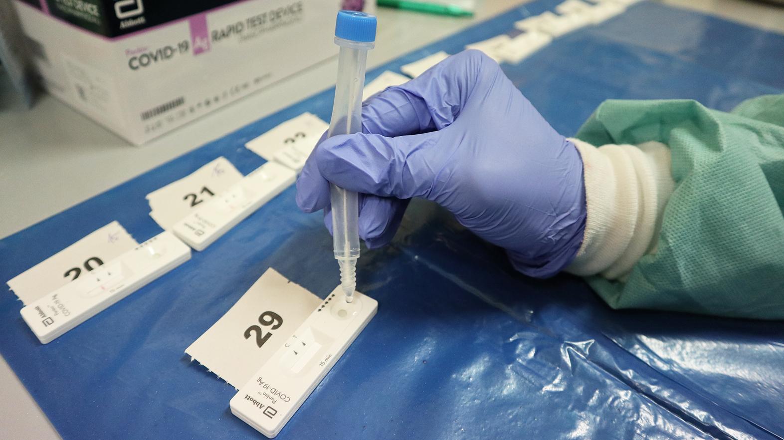 Antigénové testovanie pre samoplatcov v nemocnici už od stredy