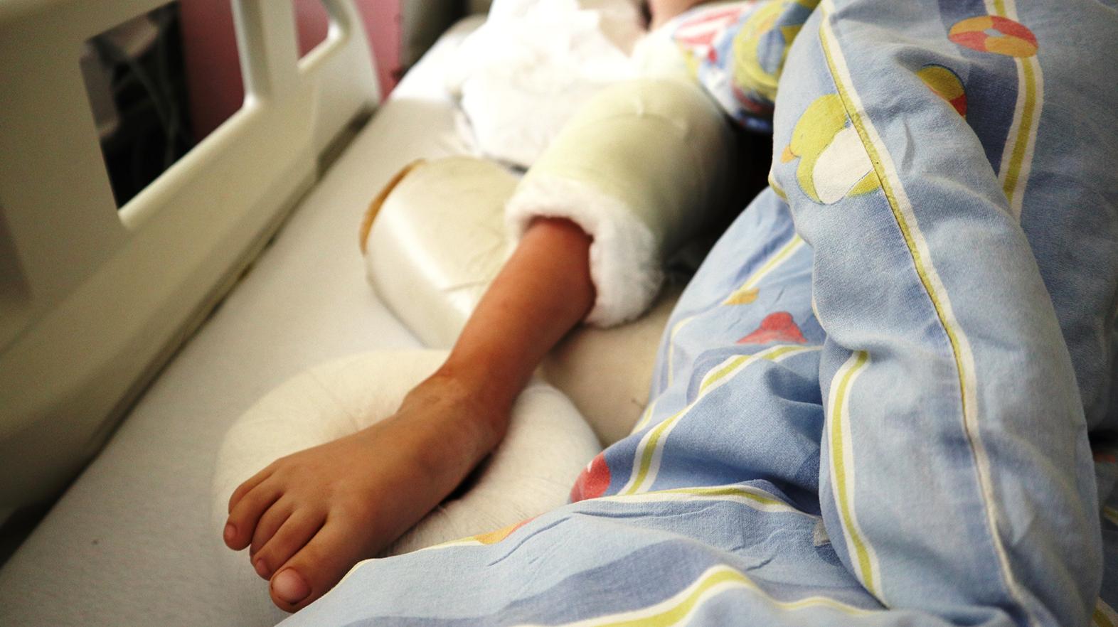 Žilinská pediatrická ortopédia zavádza do praxe novú jedinečnú metódu